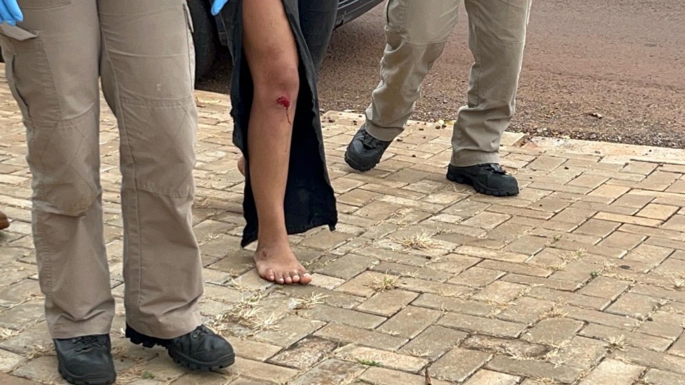 Acidente de trânsito deixa jovem ferida no bairro Floresta