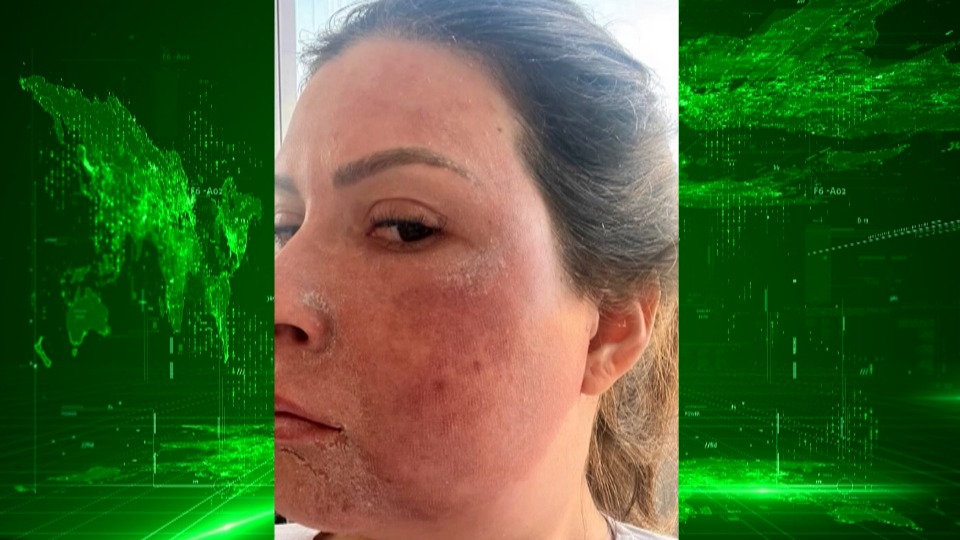 Notícia Relacionada